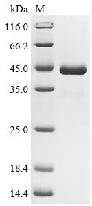 Recombinant Crimean-Congo hemorrhagic fever virus Envelopment polyprotein (GP), partial (Active) (CSB-MP810349CSC2)
