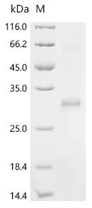 Recombinant Human Cysteine and glycine-rich protein 2 (CSRP2) (CSB-EP006084HU)