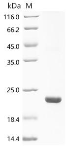 Recombinant Escherichia coli O157:H7 Uncharacterized protein yqgB (yqgB) (CSB-EP353135EODe3)