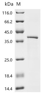 Recombinant Drosophila melanogaster Tyrosine-protein kinase hopscotch (hop), partial (CSB-EP631547DLUd7)