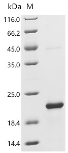 Recombinant Human C-C motif chemokine 5 (CCL5) (CSB-EP004800HUg5)