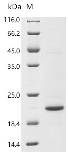 Recombinant Human C-C motif chemokine 5 (CCL5) (CSB-EP004800HUd7)