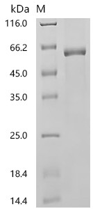 Recombinant Human E3 ubiquitin-protein ligase TRIM21 (TRIM21) (CSB-EP024457HUc7)