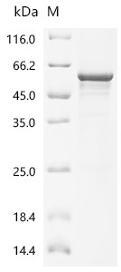 Recombinant Human Casein kinase I isoform delta (CSNK1D) (CSB-EP006067HU)