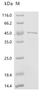 Recombinant Human Deoxyribonuclease gamma (DNASE1L3) (CSB-EP621686HUd7)