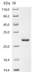Recombinant Human Diamine acetyltransferase 1(SAT1), partial (CSB-EP020717HU1c7)