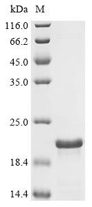 Recombinant African swine fever virus Inner membrane protein p54 (p54), partial (CSB-EP5531GOG)