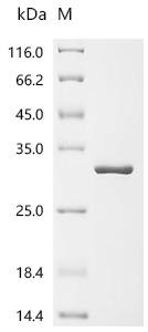 Recombinant Cowpea chlorotic mottle virus Capsid protein (ORF3b) (CSB-EP361103CRC)