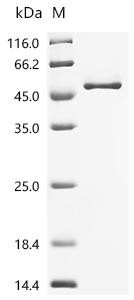 Recombinant Human Complement factor H (CFH), partial (CSB-MP005273HU(F1))