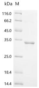 Recombinant Babesia gibsoni Thrombospondin-related adhesive protein (BgTRAP), partial (CSB-EP5951GXM)