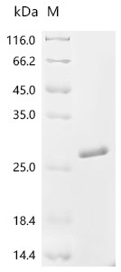 Recombinant Enterobacteria phage T4 Small outer capsid protein (soc) (CSB-EP366028EDZ)