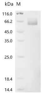 Recombinant Human Delta-like protein 4 (DLL4), partial (Active) (CSB-MP878862HU)