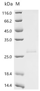 Recombinant Epstein-Barr virus latent membrane protein 1 variant (LMP1) , partial (CSB-MP5690EFC)
