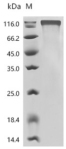 Recombinant Human Cell adhesion molecule CEACAM5 (CEACAM5), partial (CSB-MP005165HUd9)