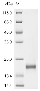 Recombinant Cavia porcellus Lipocalin Cav p 2.0101 (Lcncavp2) (CSB-YP306654GU)