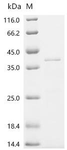 Recombinant Bordetella pertussis BrkA autotransporter (brkA), partial (CSB-EP673803BUA2c7)