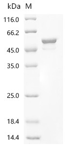 Recombinant Coccidioides immitis Endochitinase 1 (CTS1) (CSB-EP627763DUV)