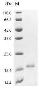Recombinant Fusarium oxysporum f. sp. lycopersici ribonuclease T1 (CSB-EP6416FFP)