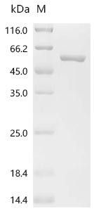 Recombinant avian paramyxovirus 4 Nucleocapsid (NP) (CSB-EP6450)