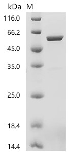 Recombinant avian paramyxovirus 4 Nucleocapsid (NP) (CSB-EP6450b1)