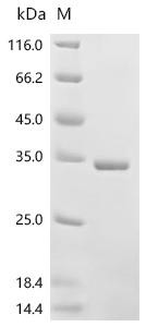 Recombinant Bordetella pertussis Pertussis toxin subunit 1 (ptxA) (R43K, E163G) (CSB-EP356423BUA(M))