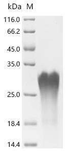Recombinant Human Enamelin (ENAM),partial (CSB-YP007662HU)
