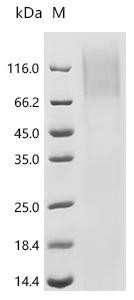 Recombinant Human Eosinophil peroxidase (EPX) (CSB-YP007756HU)