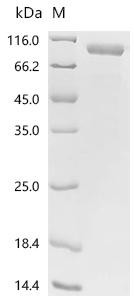 Recombinant avian paramyxovirus 4 Nucleocapsid (NP) (CSB-MP6450)