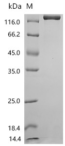 Recombinant Human Ectonucleotide pyrophosphatase/phosphodiesterase family member 3 (ENPP3), partial (CSB-MP007681HUd9)