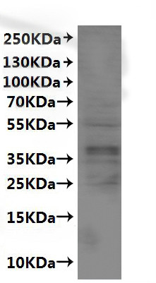 Recombinant Human CX3C chemokine receptor 1 (CX3CR1)-VLPs (CSB-MP006236HU)
