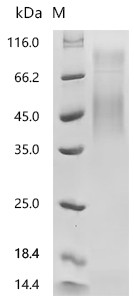Recombinant Dog CD274 molecule (PDL1), partial (CSB-MP5015DO1j9)