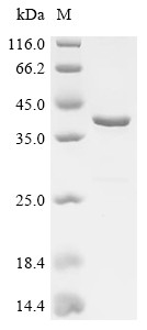Recombinant Human Atrial natriuretic peptide receptor 3 (NPR3), partial (CSB-EP016025HU2)