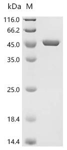 Recombinant Escherichia coli O17:K52:H18 Chorismate synthase (aroC) (CSB-EP486248EOG)