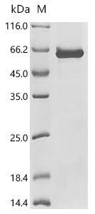Recombinant Bunyavirus snowshoe hare Envelopment polyprotein (GP), partial (CSB-EP361398BNQ)