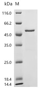 Recombinant Human Choline-phosphate cytidylyltransferase A (PCYT1A) (CSB-EP017654HU)