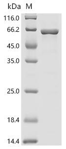 Recombinant Arabidopsis thaliana Protoporphyrinogen oxidase 2,chloroplastic/mitochondrial (PPOX2) (CSB-EP6910DOA)
