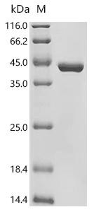 Recombinant Arabidopsis thaliana Polyubiquitin 14 (UBQ14) (CSB-EP661648DOA)