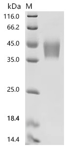 Recombinant Human Cytokine receptor-like factor 2 (CRLF2), partial, Biotinylated (CSB-MP005983HU-B)