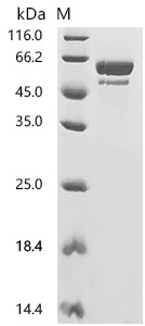 Recombinant Human Collagen alpha-1(III) chain (COL3A1), partial (CSB-MP005740HU3)
