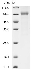 Recombinant Human Cytokine receptor-like factor 2 (CRLF2), partial (CSB-MP005983HUd9)