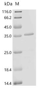 Recombinant Human DGAT1/2-independent enzyme synthesizing storage lipids (TMEM68) (CSB-CF023872HU)