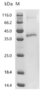 Recombinant Bovine Rhodopsin (RHO) (CSB-CF019681BOd7)