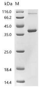 Recombinant Human Asialoglycoprotein receptor 2 (ASGR2) (CSB-CF002208HUm12)