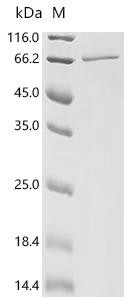 Recombinant Human DEP domain-containing protein 1B (DEPDC1B) (CSB-EP851968HU)