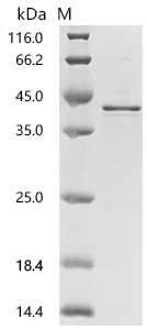 Recombinant Human Charged multivesicular body protein 4b (CHMP4B) (CSB-EP887976HUc7)