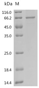 Recombinant Human Extracellular serine/threonine protein kinase FAM20C (FAM20C) (CSB-EP816901HU)
