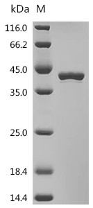 Recombinant Human Fatty acid synthase (FASN), partial (CSB-EP008435HU1)
