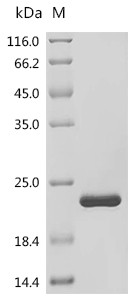 Recombinant Human Fibroblast growth factor 1 (FGF1) (CSB-EP008615HUa0)