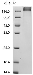 Recombinant Human CD44 antigen (CD44), partial (CSB-MP004938HU2)