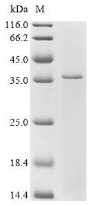 Recombinant Human Etoposide-induced protein 2.4 homolog (EI24) (CSB-CF007498HU(A4))
